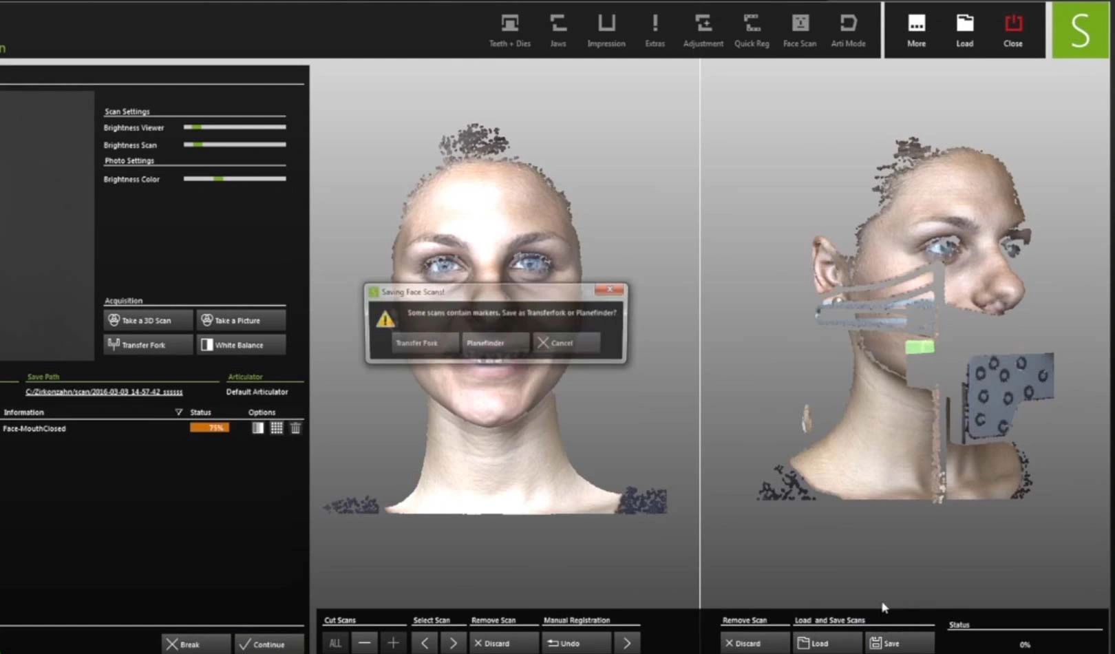 Zirkonzahn 3D Facial Scanner